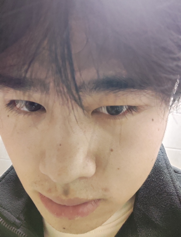 伤男的第一张照片--金门交友网